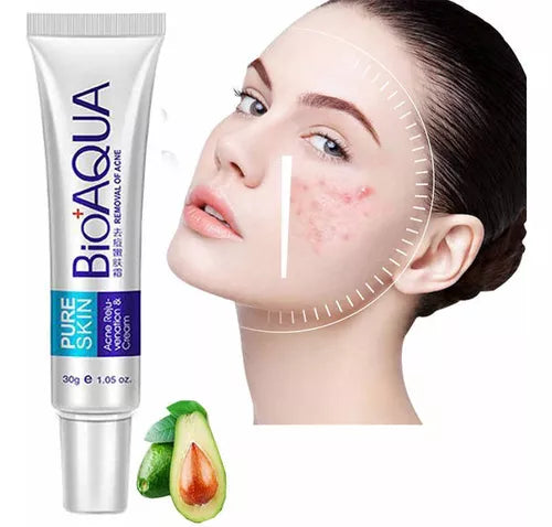 Bioaqua Crema Removedora De Acne Original Pure Skin Removal